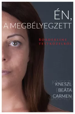 Én, a megbélyegzett - Borderline testközelből